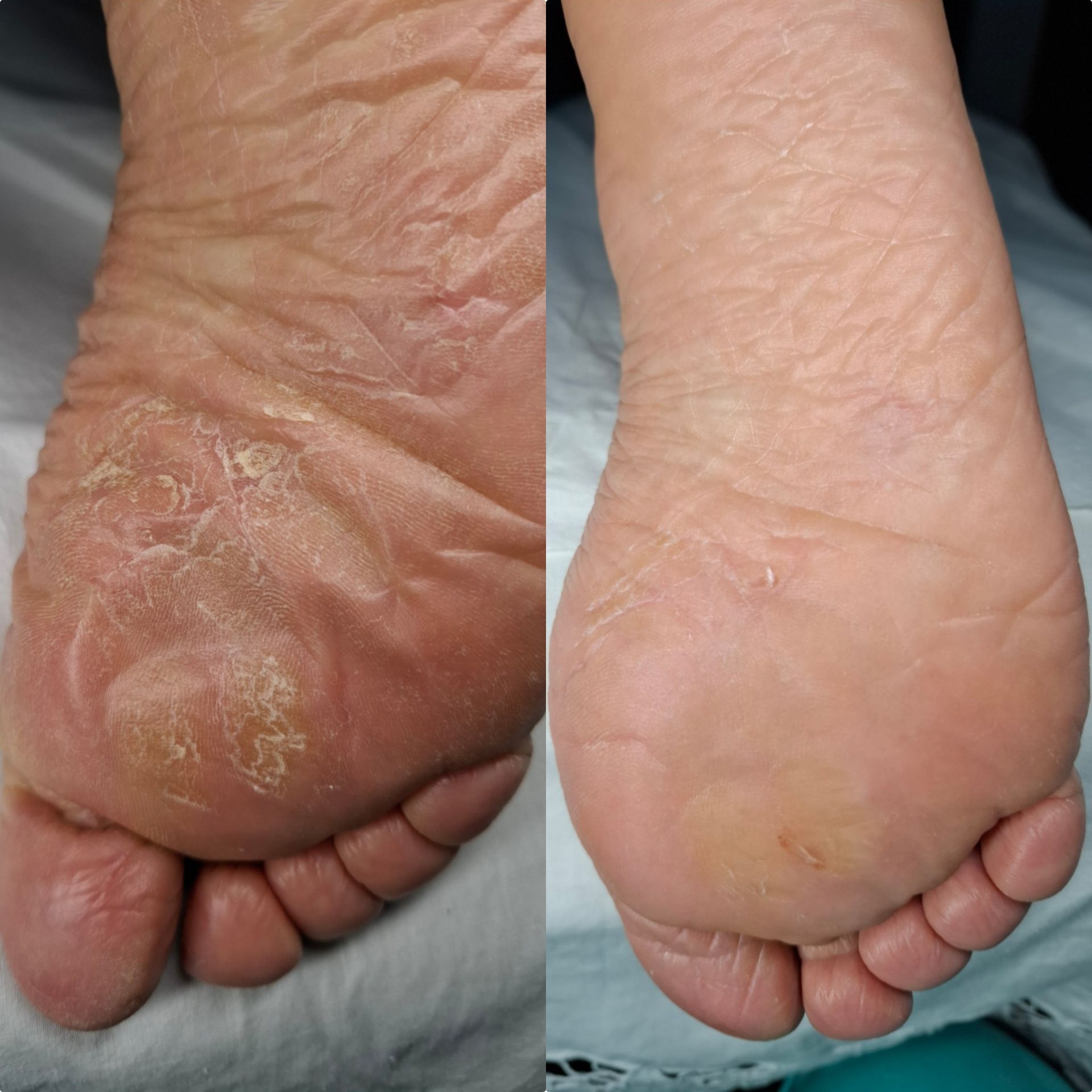 Caso Dermatología Podal — Lucía Lago